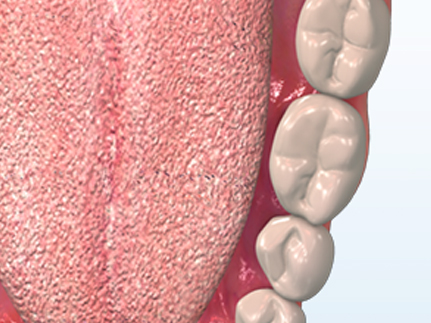 orthodontic terms and appliances