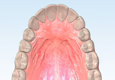 orthodontic terms and appliances