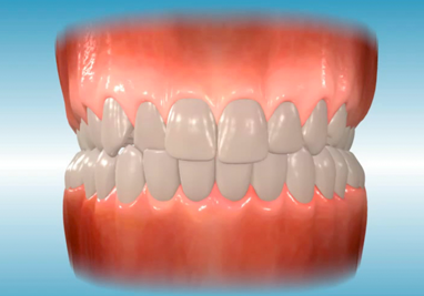 common orthodontic problems