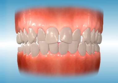 common orthodontic problems