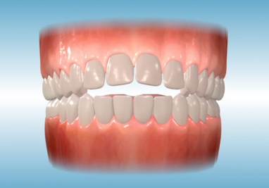 common orthodontic problems