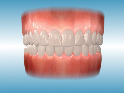 common orthodontic problems