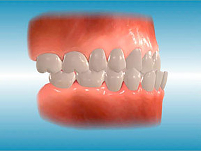 common orthodontic problems