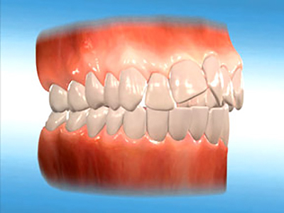 common orthodontic problems